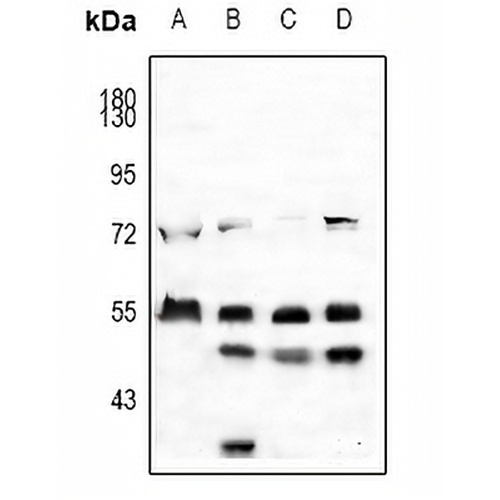 EGR Rabbit Polyclonal Antibody