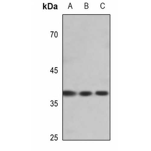 EIF2S1 (Phospho-S51) Rabbit Polyclonal Antibody