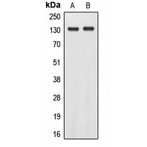 EPHA2 (Phospho-Y588) Rabbit Polyclonal Antibody