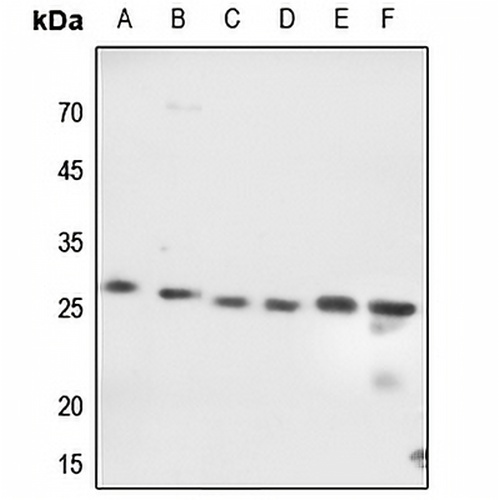 EIF4E Rabbit Polyclonal Antibody