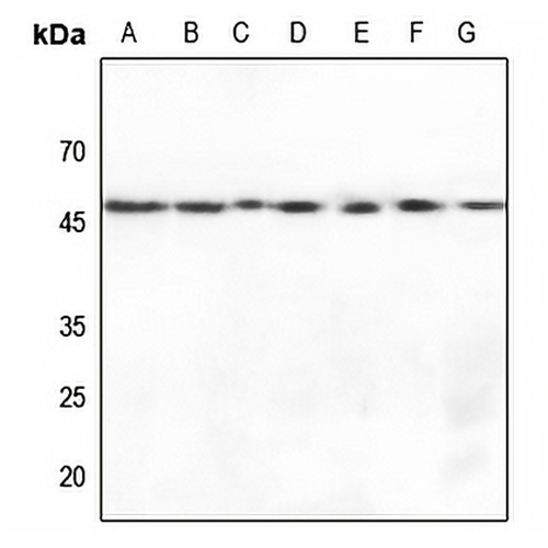Gamma-enolase Rabbit Polyclonal Antibody