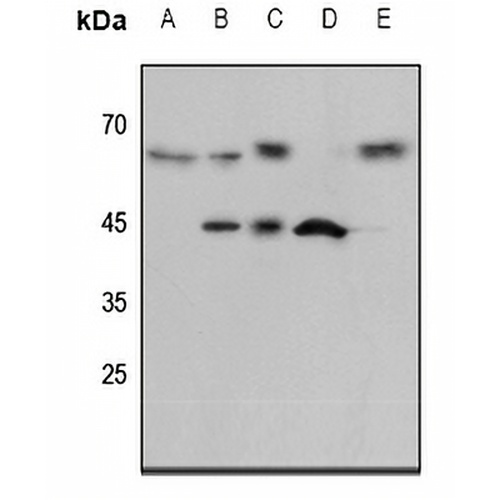 ENT1 Rabbit Polyclonal Antibody