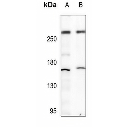 p300 Rabbit Polyclonal Antibody