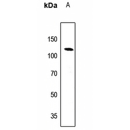 EPB41L2 Rabbit Polyclonal Antibody
