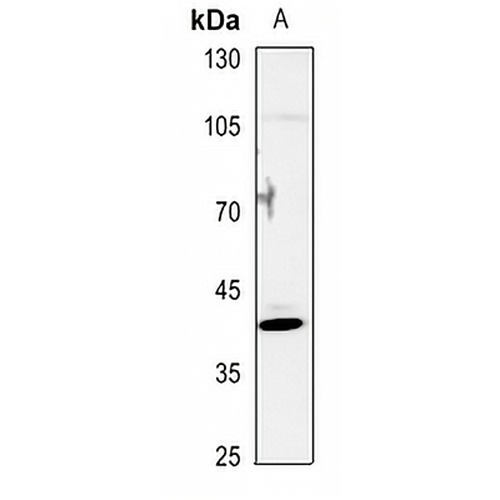 NR2F6 Rabbit Polyclonal Antibody