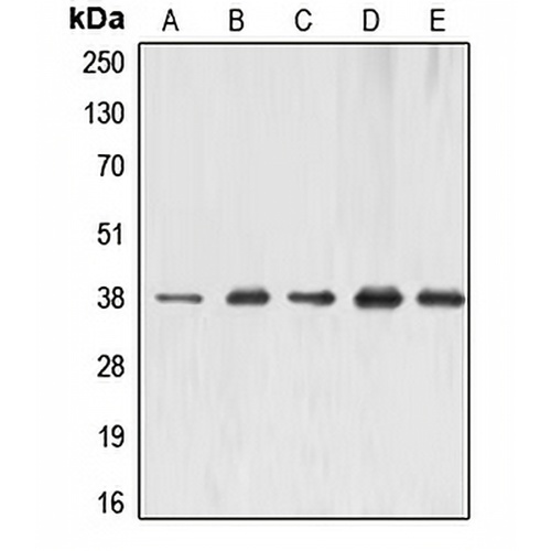 ERCC1 Rabbit Polyclonal Antibody