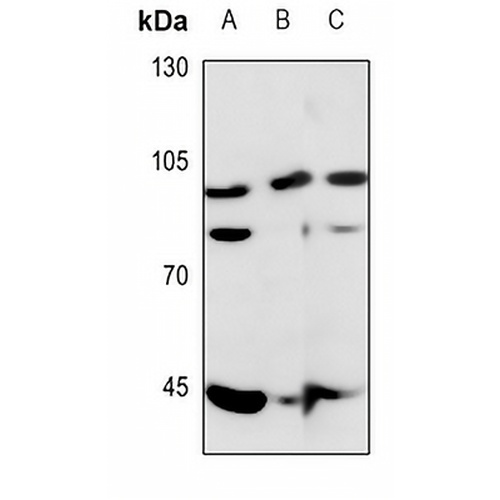 ERCC4 Rabbit Polyclonal Antibody