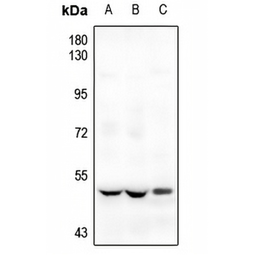 ETV1 Rabbit Polyclonal Antibody