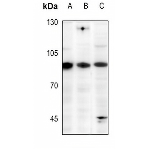EWS Rabbit Polyclonal Antibody