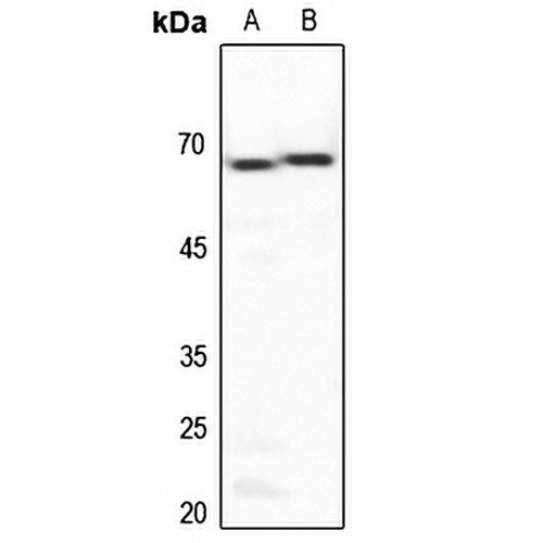 PAR1 Rabbit Polyclonal Antibody