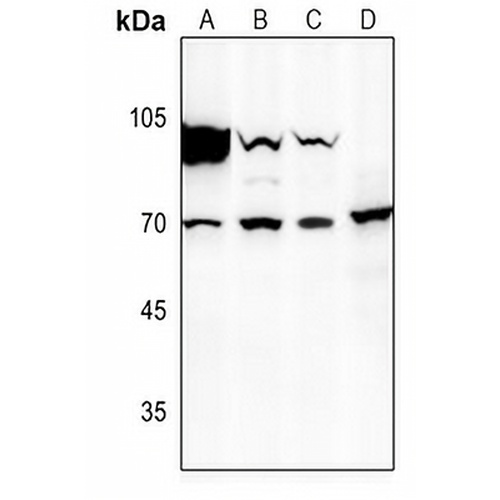 Factor X HC Rabbit Polyclonal Antibody