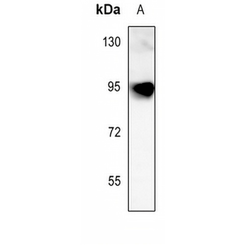 Fibulin 1 Rabbit Polyclonal Antibody