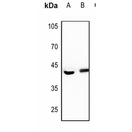 FEN1 Rabbit Polyclonal Antibody