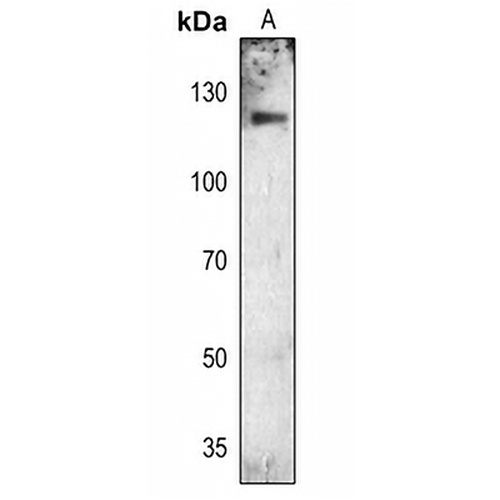 FGFR1 (Phospho-Y654) Rabbit Polyclonal Antibody