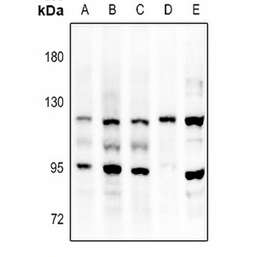 FGFR3 Rabbit Polyclonal Antibody