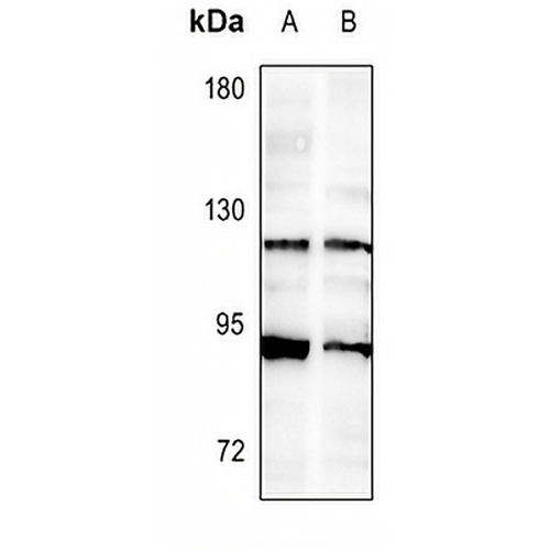FGFR2 Rabbit Polyclonal Antibody