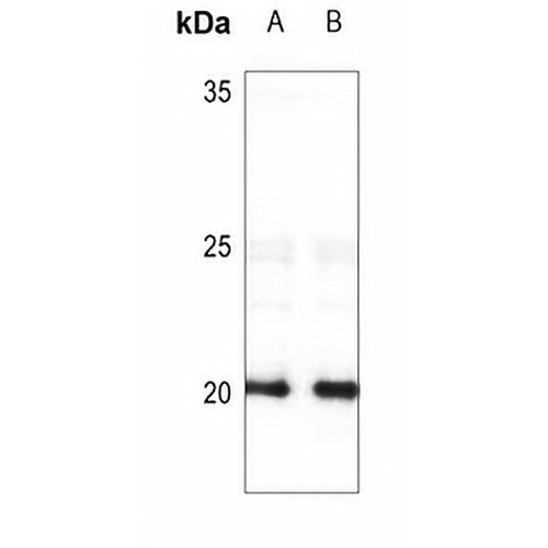 FHIT Rabbit Polyclonal Antibody