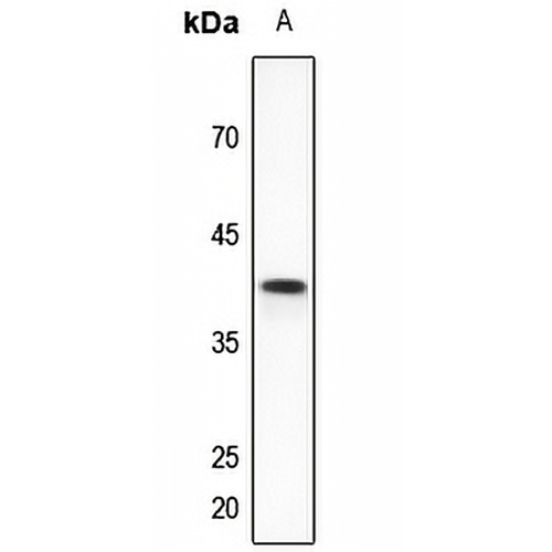 VEGFD Rabbit Polyclonal Antibody