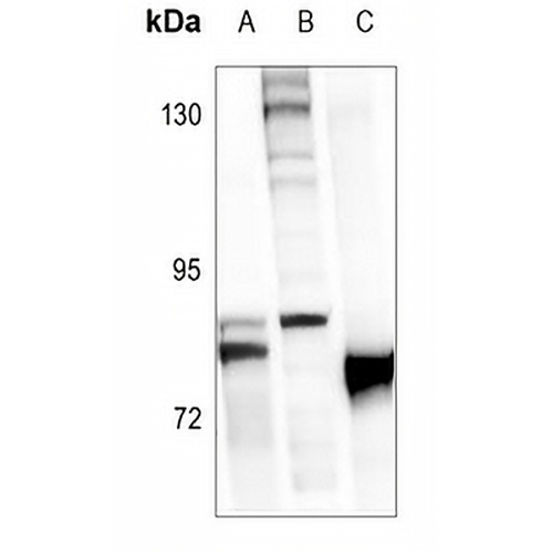 FOXO1 (Phospho-S319) Rabbit Polyclonal Antibody