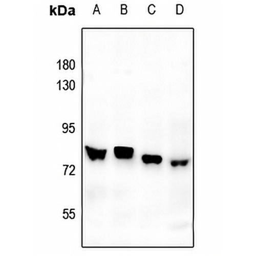 FOXO1 Rabbit Polyclonal Antibody