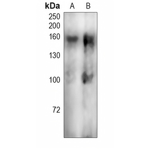 VEGFR1 (Phospho-Y1213) Rabbit Polyclonal Antibody