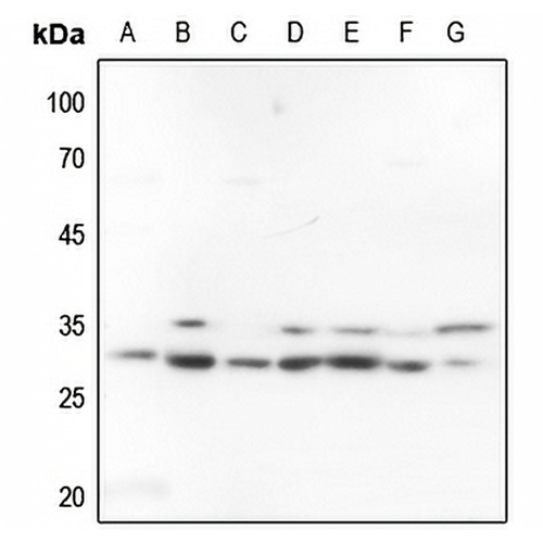 FRA2 Rabbit Polyclonal Antibody