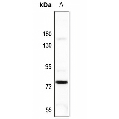 FSHR Rabbit Polyclonal Antibody