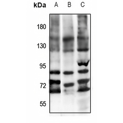 FSHR Rabbit Polyclonal Antibody