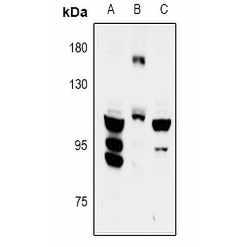 FYB Rabbit Polyclonal Antibody
