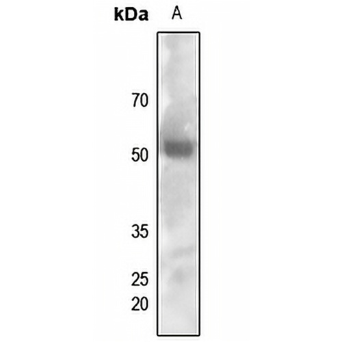 FYN (Phospho-Y530) Rabbit Polyclonal Antibody