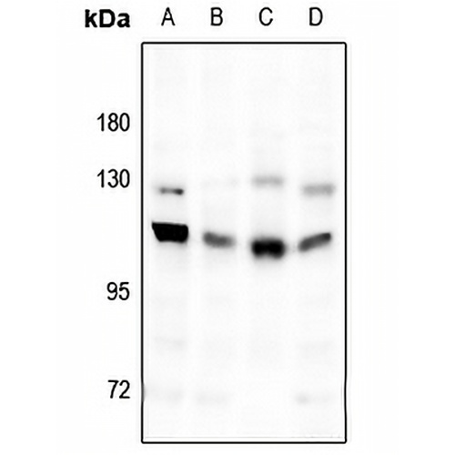 GABBR1 Rabbit Polyclonal Antibody