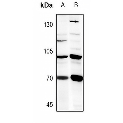 B4GALNT1 Rabbit Polyclonal Antibody