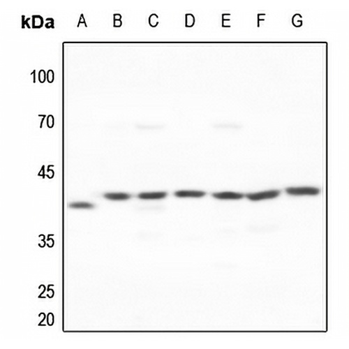 Galactose Kinase Rabbit Polyclonal Antibody