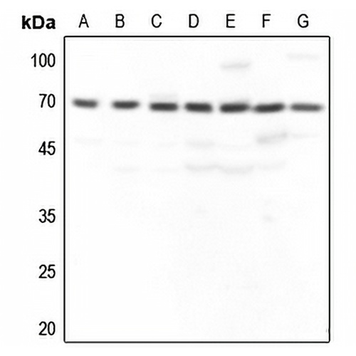GBP3 Rabbit Polyclonal Antibody
