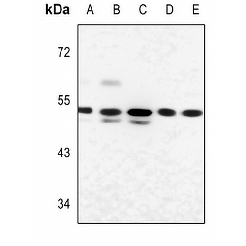 Glucagon Receptor Rabbit Polyclonal Antibody