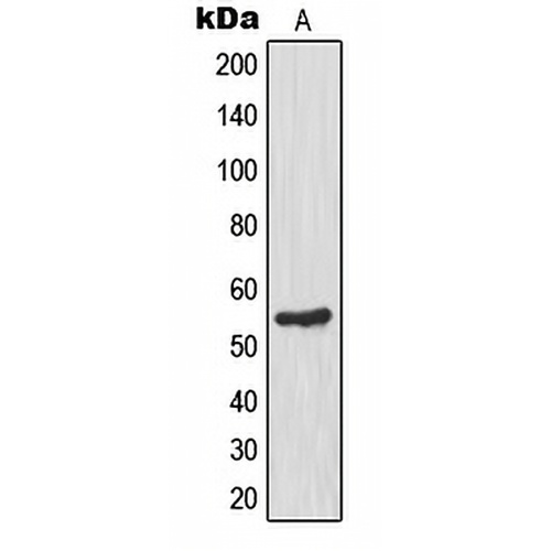 Glucokinase Rabbit Polyclonal Antibody