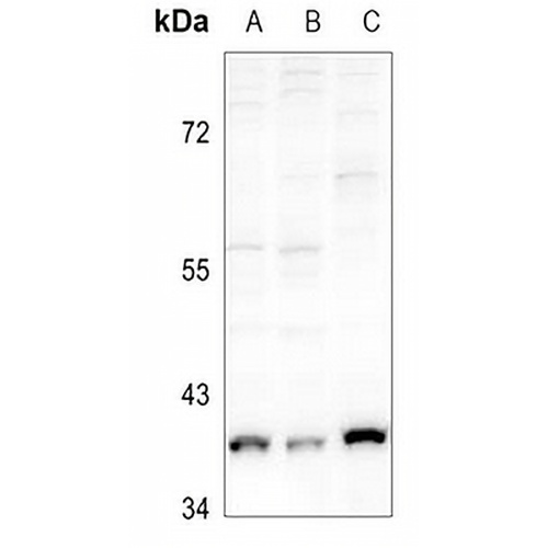 GDF1 Rabbit Polyclonal Antibody