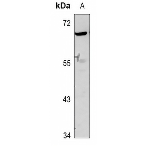 GDF9 Rabbit Polyclonal Antibody