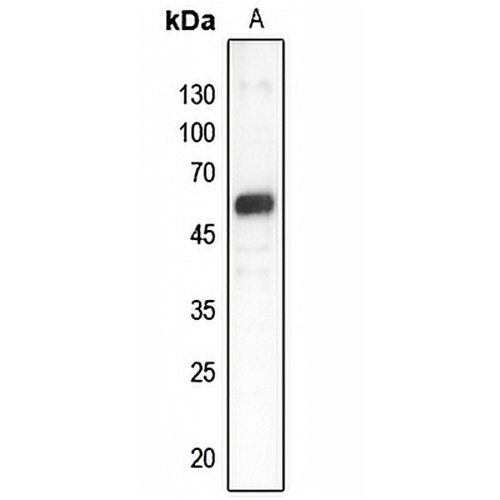GDI1 Rabbit Polyclonal Antibody