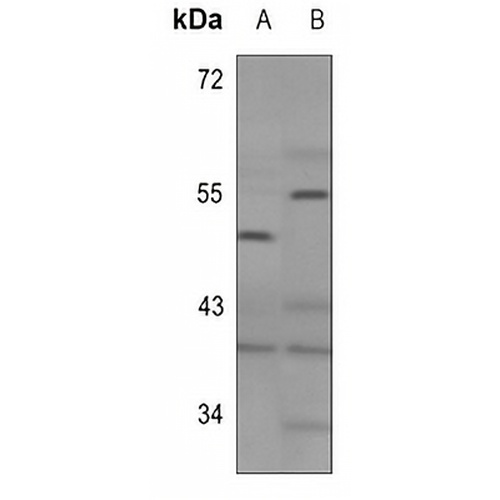 GHRH Receptor Rabbit Polyclonal Antibody