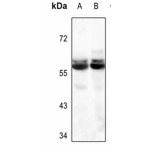 Glycerol Kinase 1 Rabbit Polyclonal Antibody