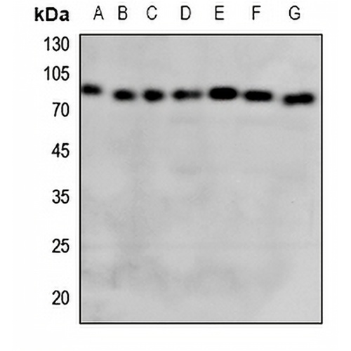 GCLC Rabbit Polyclonal Antibody