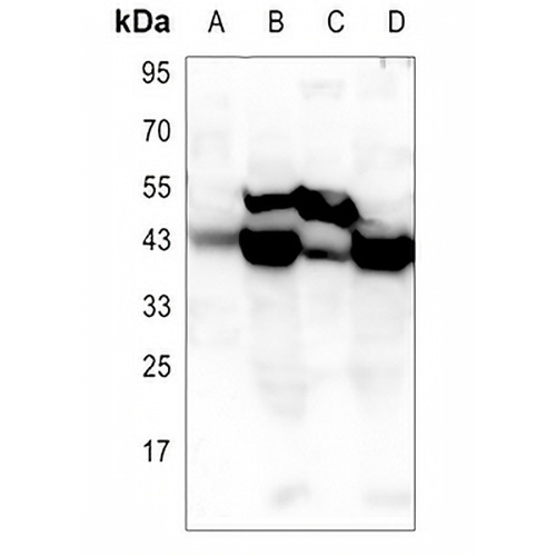 Glutamine Synthetase Rabbit Polyclonal Antibody