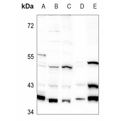 GNAI1 Rabbit Polyclonal Antibody