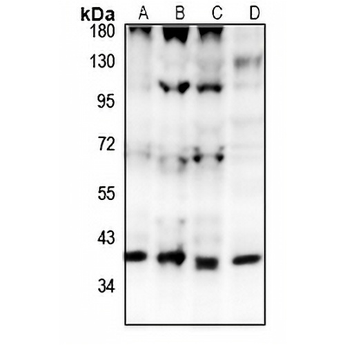 GPR15 Rabbit Polyclonal Antibody