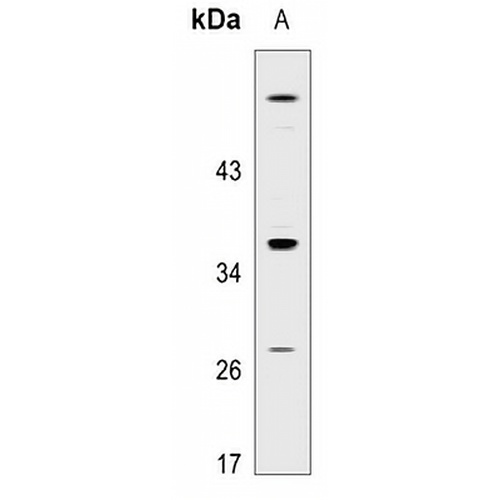 GPR18 Rabbit Polyclonal Antibody