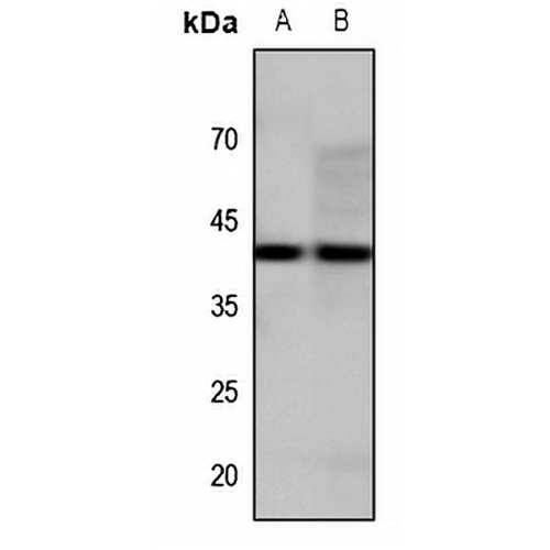 GPR34 Rabbit Polyclonal Antibody