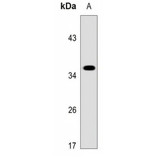 GPR41 Rabbit Polyclonal Antibody