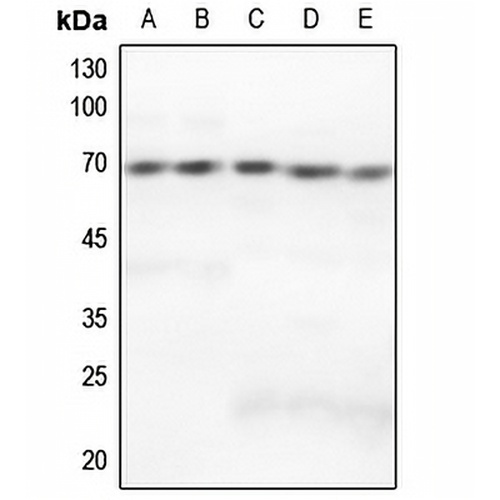 GRK5 Rabbit Polyclonal Antibody