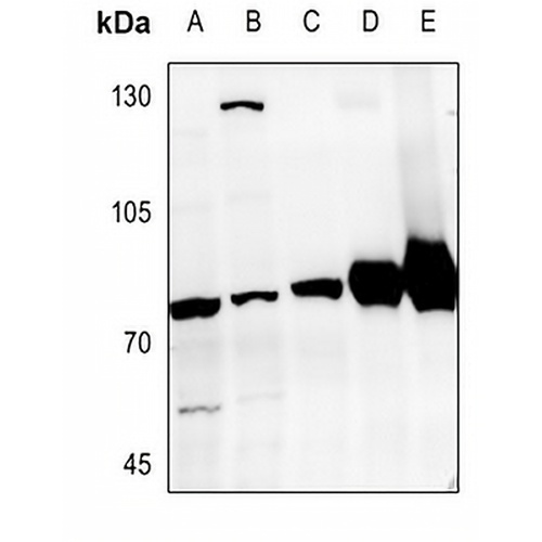GRK6 Rabbit Polyclonal Antibody